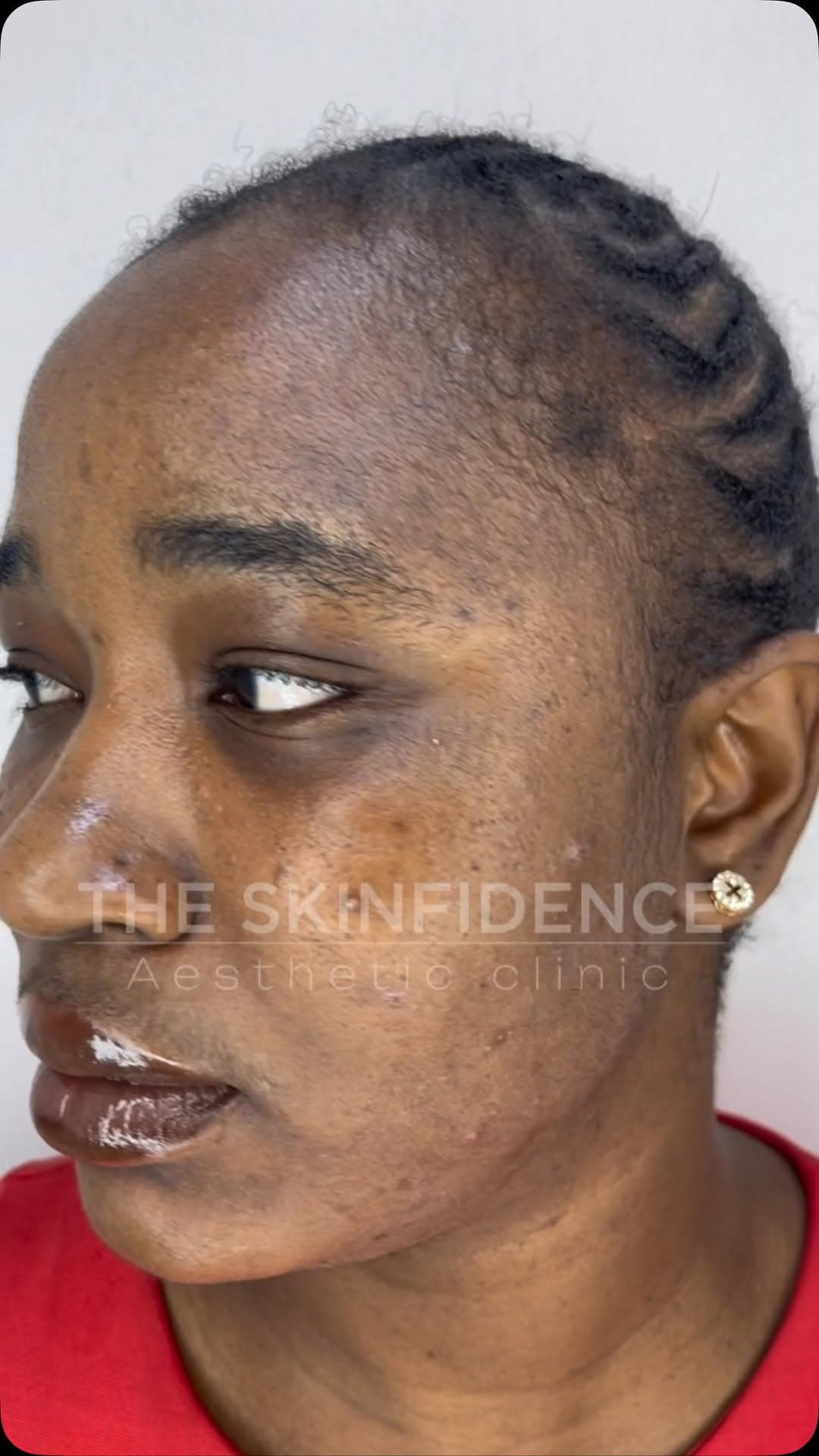 A real client case at The Skinfidence
