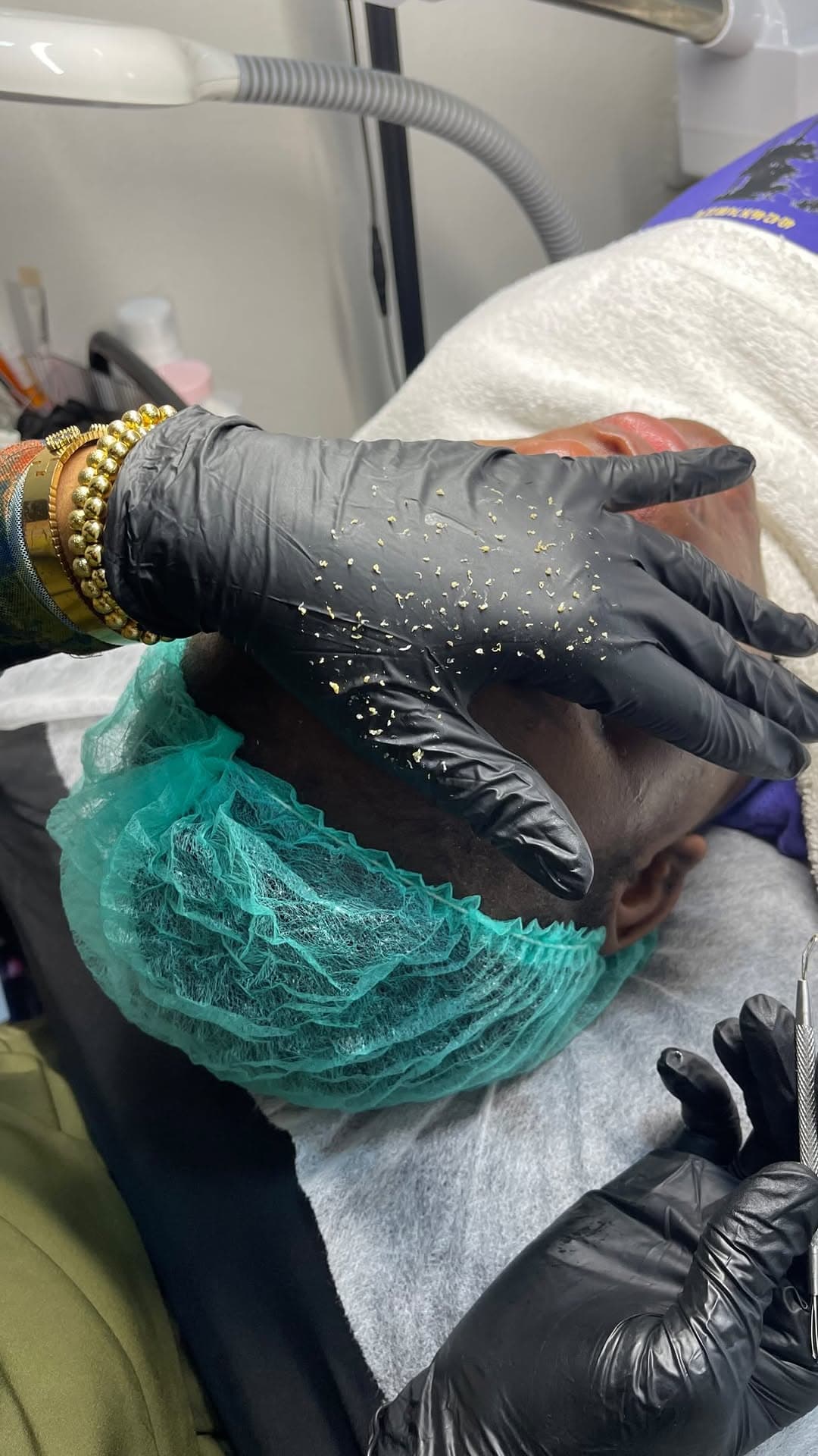 Microneedling